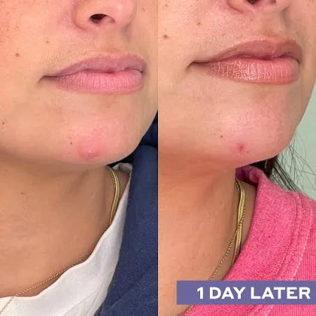 Daily SOS Rescue Hypochlorous Acid Facial Spray
